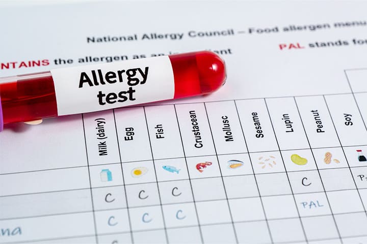 アレルギー検査